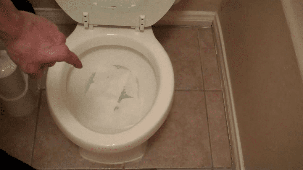 Toilet Water Splashback Disease 